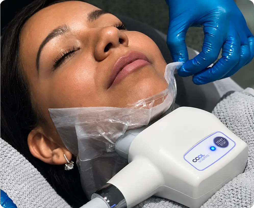Chin & Back Fat Treatment
